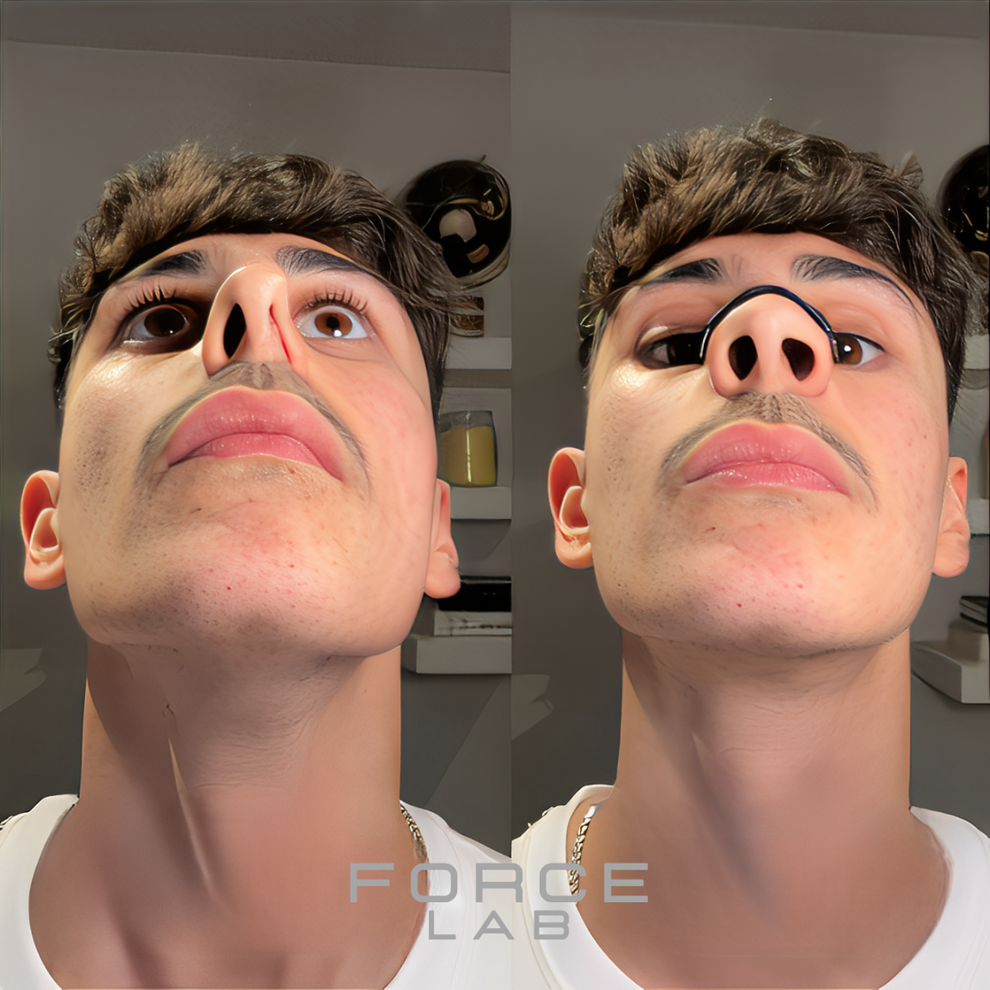 Tiras Nasales Extra Fuertes para Mejorar la Respiración